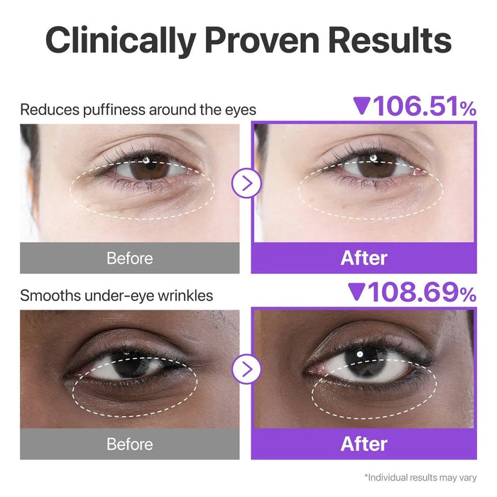 NUMBUZIN No.9 NAD+ Collagen Under Eye Patches (5 Pairs) - DOKAN
